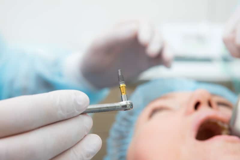 dentist performing a dental implant procedure