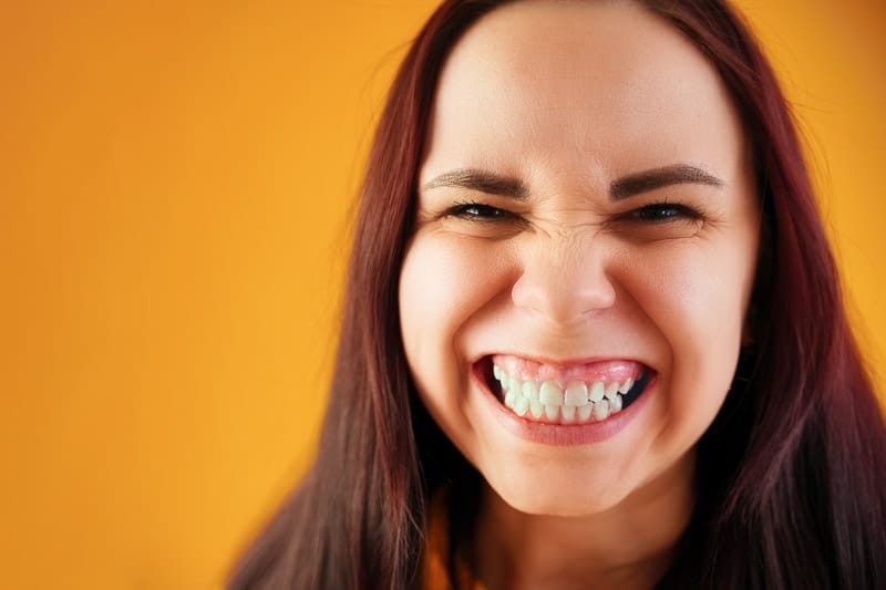 woman smiling with overbite